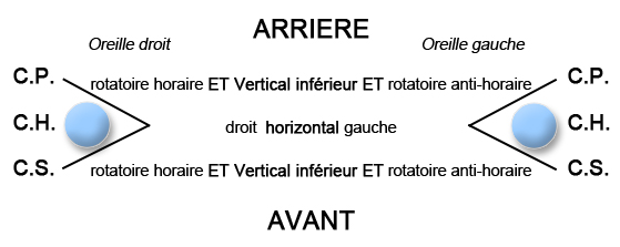 Nystagmus Spontané sous VNS pour l'exploration vestibulaire